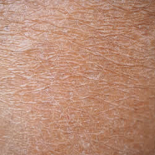 Dry Skin vs Dehydrated Skin: How to Finally Tell the Difference and Fix What’s Really Going On